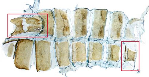 Aethes hartmanniana